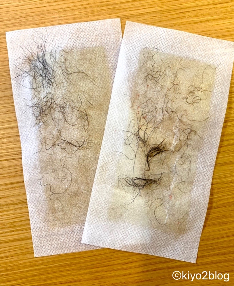 メンズゴリラ ワックス脱毛シートでＶＩＯの脱毛