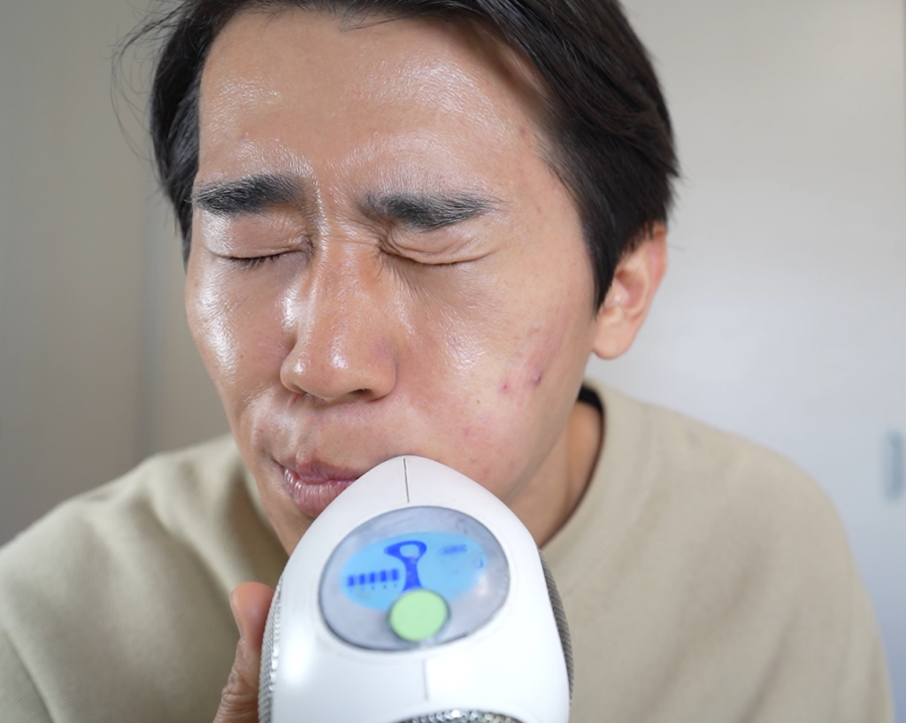 トリアでヒゲ脱毛は痛い