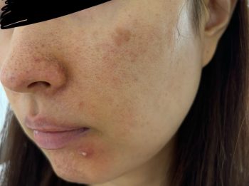 キヨキヨの美容コーチングビフォーアフター