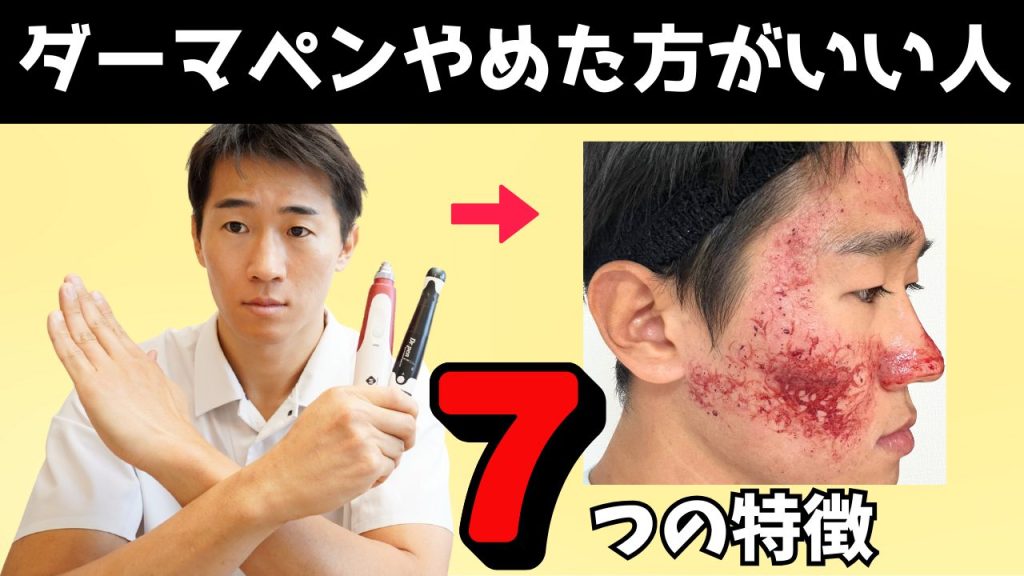ダーマペンをやめた方がいい人 7つの特徴とは？セルフダーマペンから美容医療まで