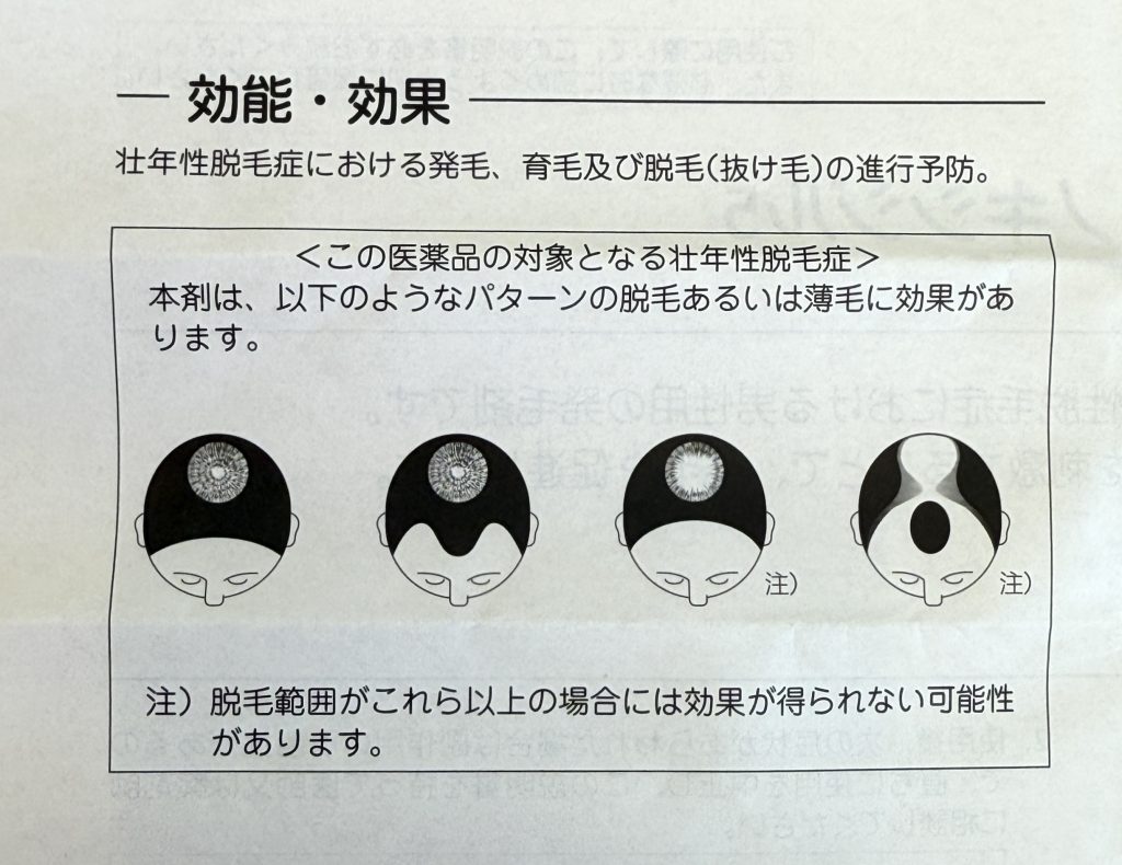 ヒックスミノキシジルの効果