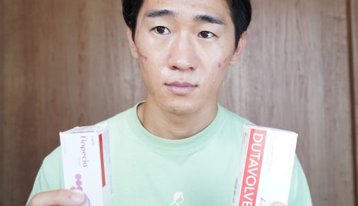 【体験談】デュタボルブを半年飲んでみた効果と経過！デュタステリドで薄毛は治る？【口コミ・評判】