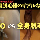 ケノンを使った5年後のリアルな経過。家庭用脱毛器で本当に全身脱毛できるのか…？