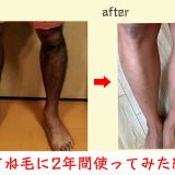 ブラウン シルクエキスパート pro5 の経過！リアルな口コミとレビューを集めてみた結果、、、