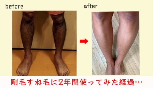 ブラウン シルクエキスパート pro5 の経過！リアルな口コミとレビューを集めてみた結果、、、